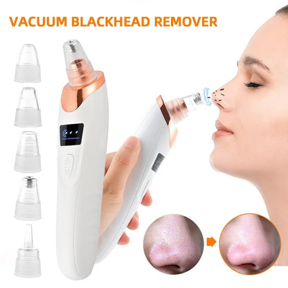 Portable Electric Blackhead Remover | USB Pore Vacuum Cleaner