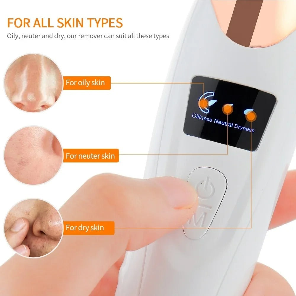 Portable Electric Blackhead Remover | USB Pore Vacuum Cleaner