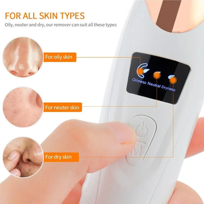 Portable Electric Blackhead Remover | USB Pore Vacuum Cleaner