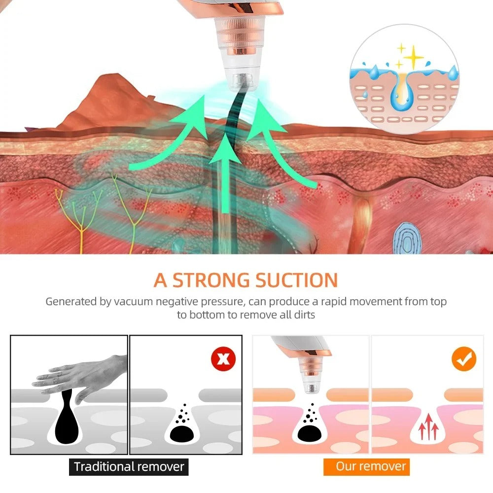 Portable Electric Blackhead Remover | USB Pore Vacuum Cleaner
