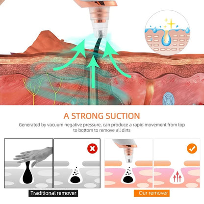 Portable Electric Blackhead Remover | USB Pore Vacuum Cleaner
