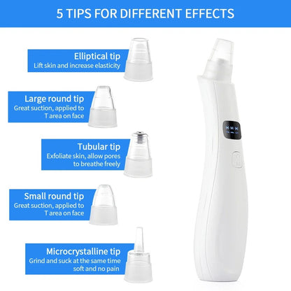 Portable Electric Blackhead Remover | USB Pore Vacuum Cleaner